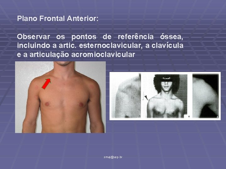Plano Frontal Anterior: Observar os pontos de referência óssea, incluindo a artic. esternoclavicular, a