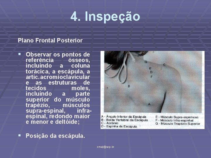 4. Inspeção Plano Frontal Posterior § Observar os pontos de referência ósseos, incluindo a