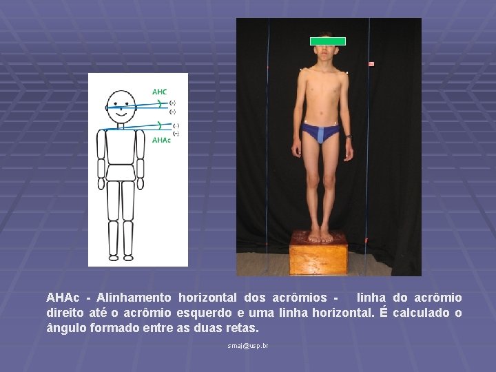 AHAc - Alinhamento horizontal dos acrômios linha do acrômio direito até o acrômio esquerdo