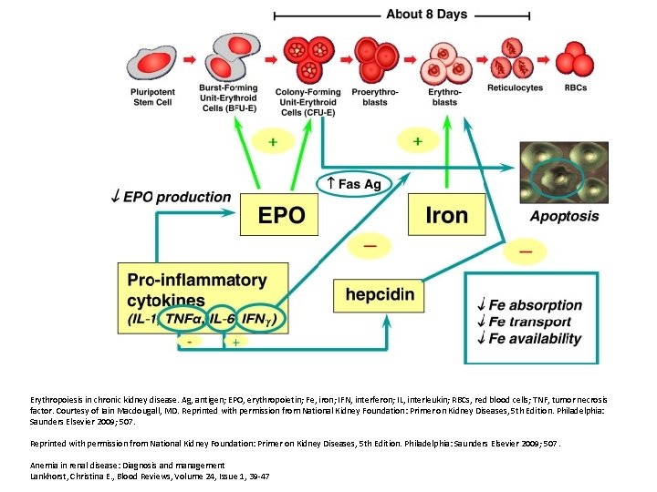 Erythropoiesis in chronic kidney disease. Ag, antigen; EPO, erythropoietin; Fe, iron; IFN, interferon; IL,