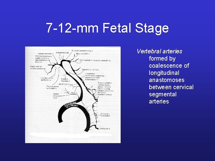 7 -12 -mm Fetal Stage Vertebral arteries formed by coalescence of longitudinal anastomoses between
