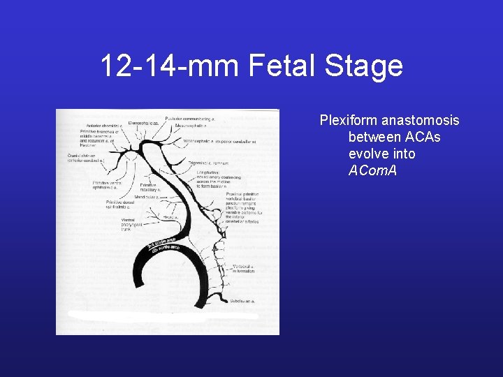 12 -14 -mm Fetal Stage Plexiform anastomosis between ACAs evolve into ACom. A 