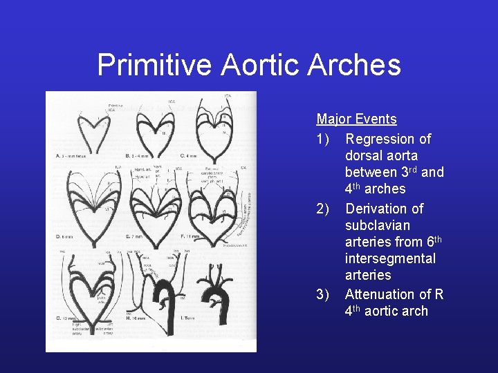 Primitive Aortic Arches Major Events 1) Regression of dorsal aorta between 3 rd and