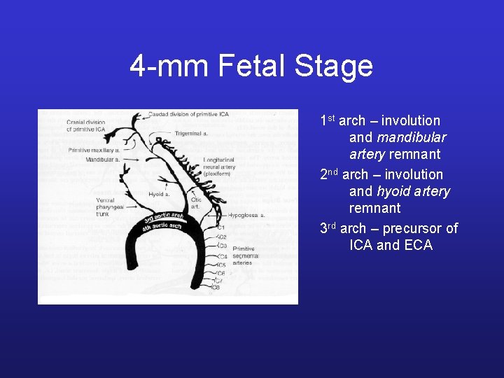 4 -mm Fetal Stage 1 st arch – involution and mandibular artery remnant 2