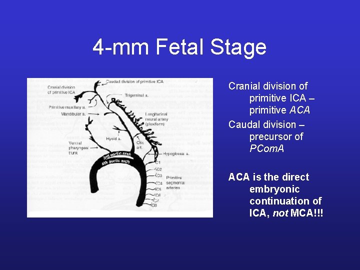 4 -mm Fetal Stage Cranial division of primitive ICA – primitive ACA Caudal division