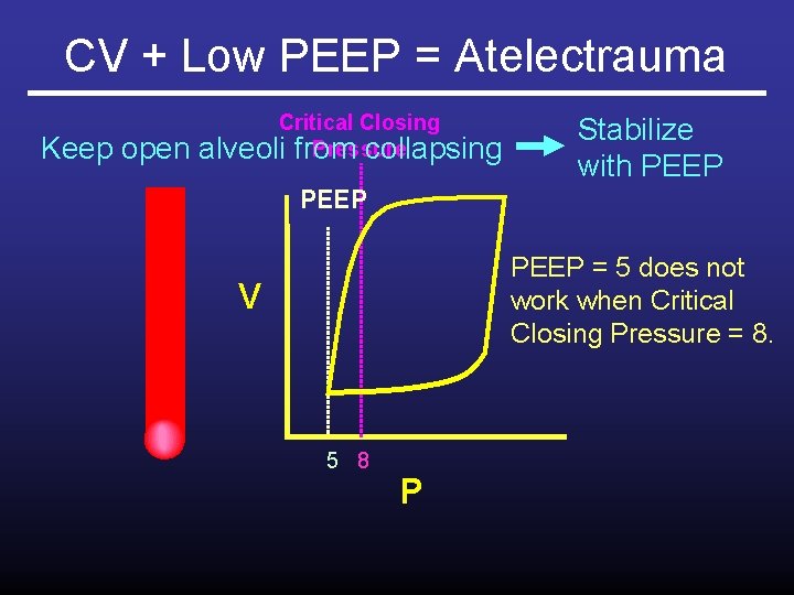 CV + Low PEEP = Atelectrauma Keep open Critical Closing Pressure alveoli from collapsing