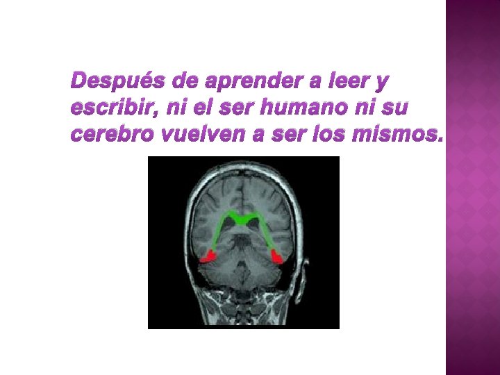 Después de aprender a leer y escribir, ni el ser humano ni su cerebro