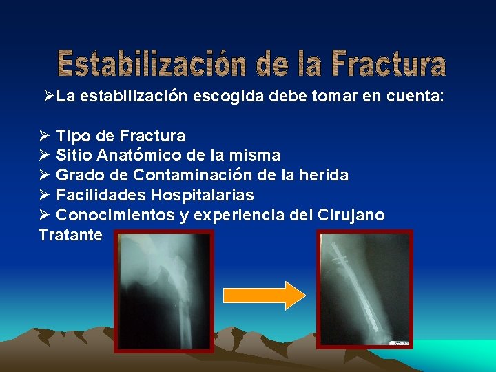 ØLa estabilización escogida debe tomar en cuenta: Ø Tipo de Fractura Ø Sitio Anatómico