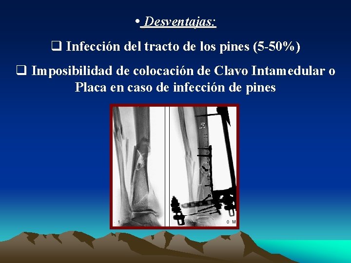  • Desventajas: q Infección del tracto de los pines (5 -50%) q Imposibilidad