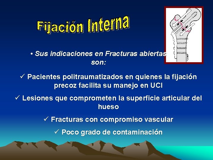  • Sus indicaciones en Fracturas abiertas son: ü Pacientes politraumatizados en quienes la