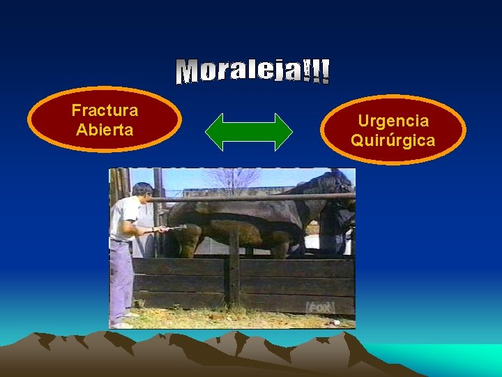 Fractura Abierta Urgencia Quirúrgica 