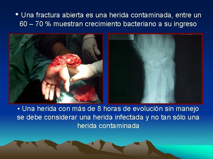  • Una fractura abierta es una herida contaminada, entre un 60 – 70