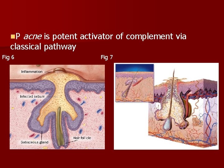 n. P acne is potent activator of complement via classical pathway Fig 6 Fig