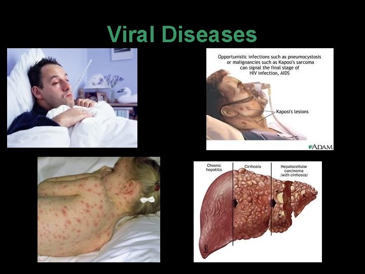 Viral Diseases 