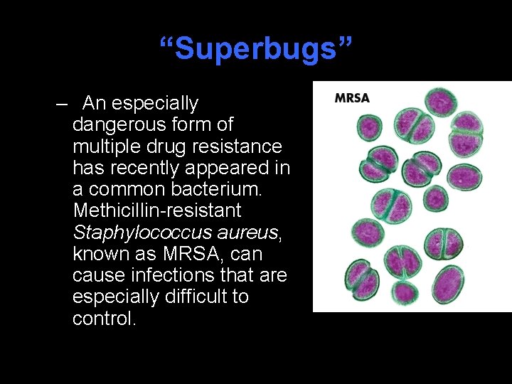 “Superbugs” – An especially dangerous form of multiple drug resistance has recently appeared in