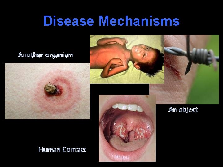Disease Mechanisms Another organism An object Human Contact 