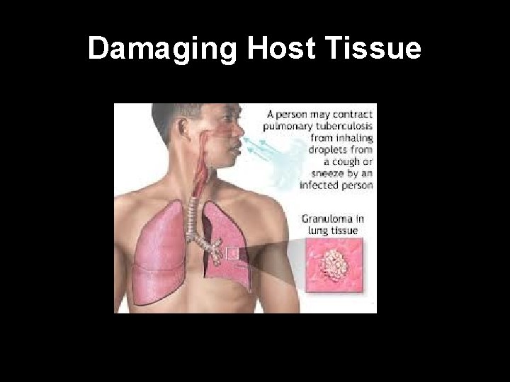 Damaging Host Tissue 