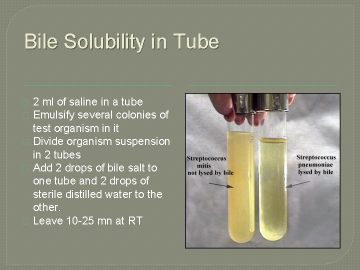 Bile Solubility in Tube � � � 2 ml of saline in a tube