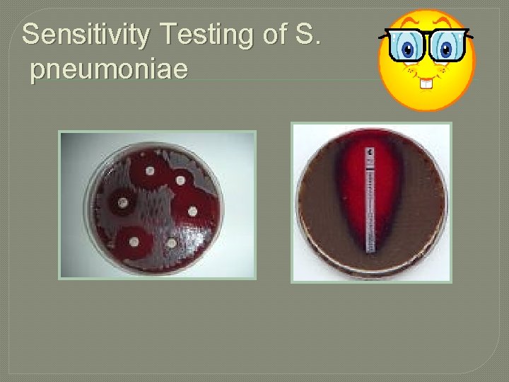 Sensitivity Testing of S. pneumoniae 