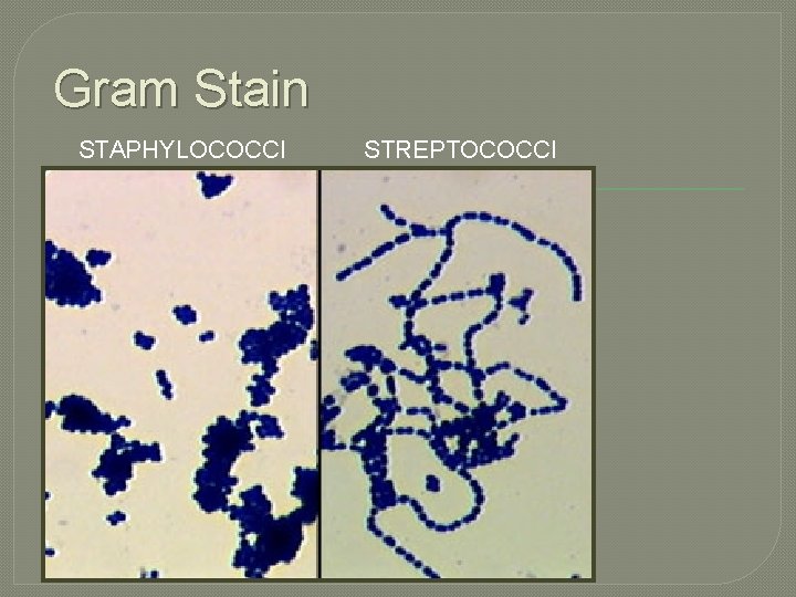 Gram Stain STAPHYLOCOCCI STREPTOCOCCI 