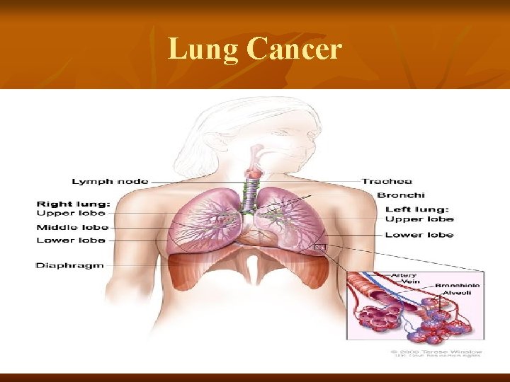 Lung Cancer 