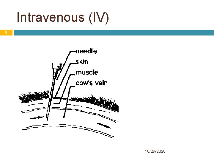 Intravenous (IV) 9 10/29/2020 