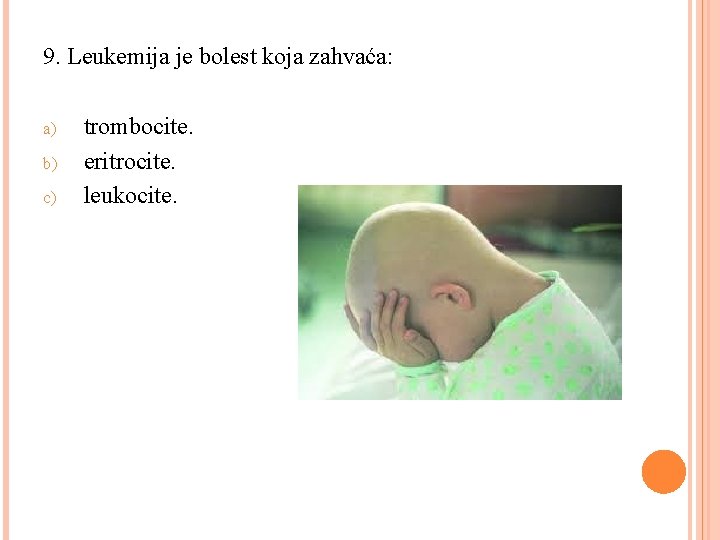 9. Leukemija je bolest koja zahvaća: a) b) c) trombocite. eritrocite. leukocite. 