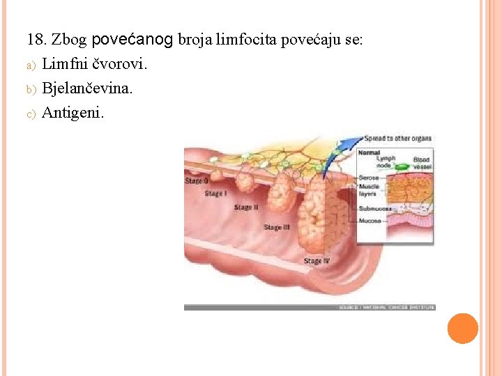 18. Zbog povećanog broja limfocita povećaju se: a) Limfni čvorovi. b) Bjelančevina. c) Antigeni.