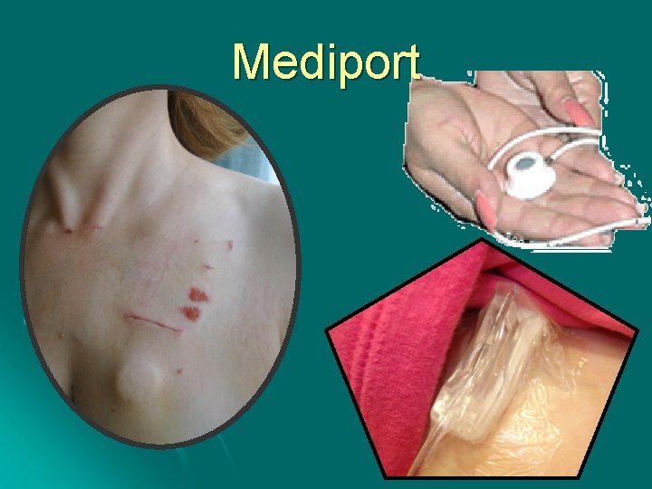 Mediport 