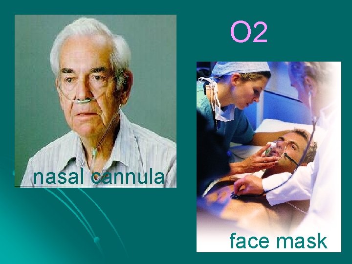 O 2 nasal cannula face mask 