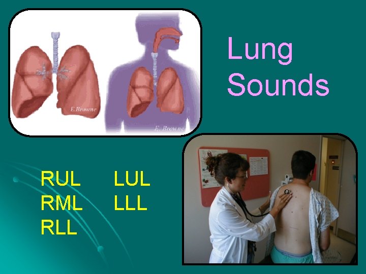 Lung Sounds RUL RML RLL LUL LLL 