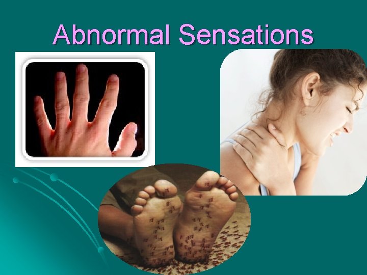 Abnormal Sensations 