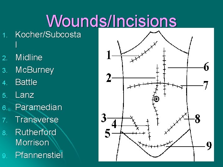 Wounds/Incisions 1. 2. 3. 4. 5. 6. 7. 8. 9. Kocher/Subcosta l Midline Mc.