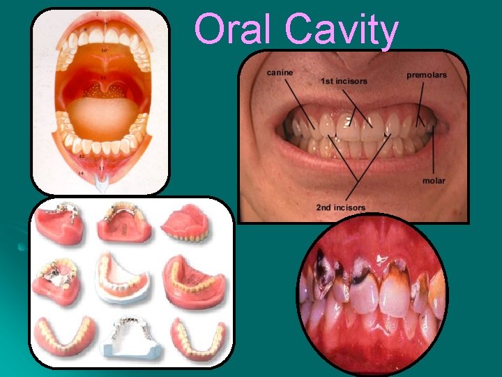 Oral Cavity 