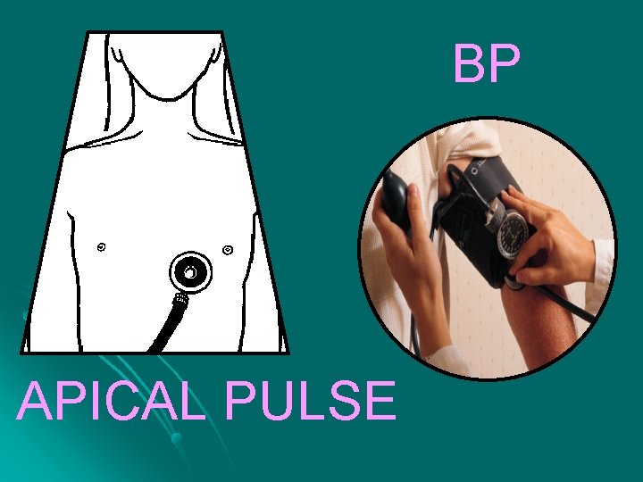 BP APICAL PULSE 