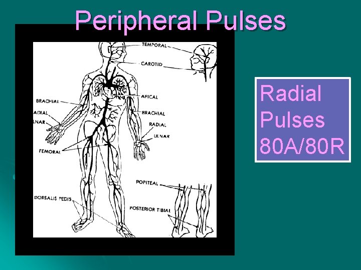 Peripheral Pulses Radial Pulses 80 A/80 R 