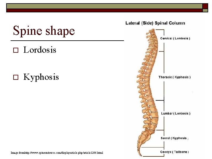 Spine shape o Lordosis o Kyphosis Image fromhttp: //www. spineuniverse. com/displayarticle. php/article 1286. html