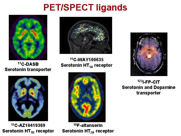 PET/SPECT ligands 11 C-DASB Serotonin transporter 11 C-WAY 100635 Serotonin HT 1 A receptor