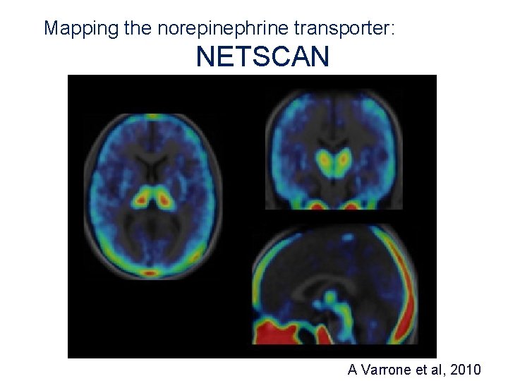 Mapping the norepinephrine transporter: NETSCAN A Varrone et al, 2010 