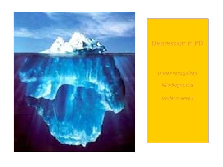 Depression in PD Under recognized Misdiagnosed Under treated 