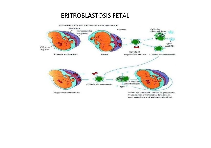 ERITROBLASTOSIS FETAL 