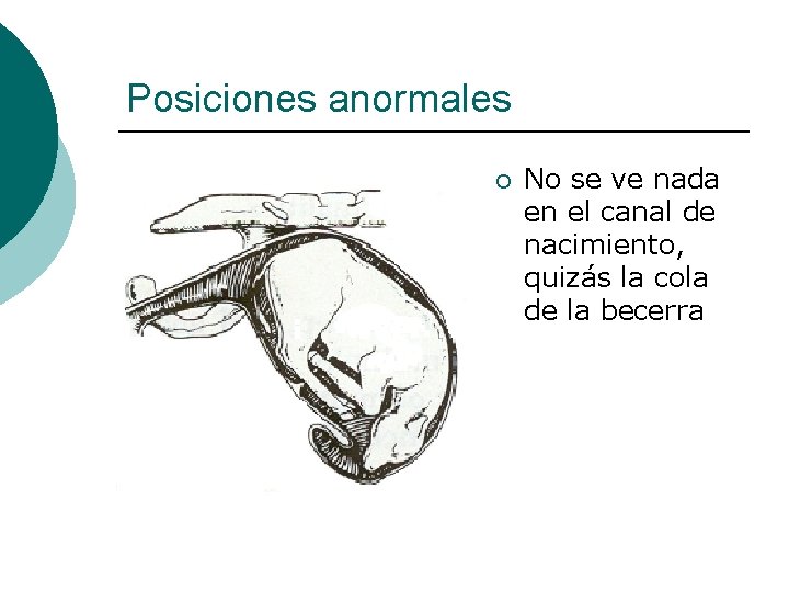 Posiciones anormales ¡ No se ve nada en el canal de nacimiento, quizás la