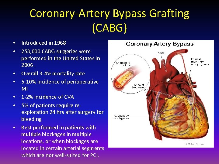 Coronary-Artery Bypass Grafting (CABG) • • Introduced in 1968 253, 000 CABG surgeries were