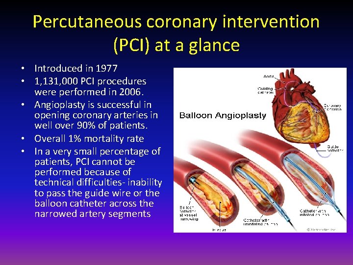 Percutaneous coronary intervention (PCI) at a glance • Introduced in 1977 • 1, 131,