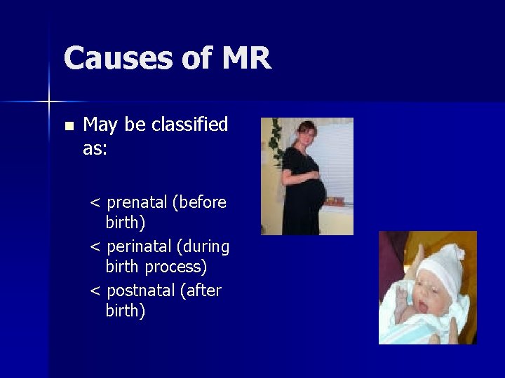 Causes of MR n May be classified as: < prenatal (before birth) < perinatal