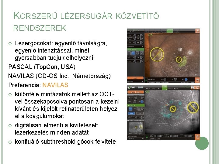 KORSZERŰ LÉZERSUGÁR KÖZVETÍTŐ RENDSZEREK Lézergócokat: egyenlő távolságra, egyenlő intenzitással, minél gyorsabban tudjuk elhelyezni PASCAL KORSZERŰ LÉZERSUGÁR KÖZVETÍTŐ RENDSZEREK Lézergócokat: egyenlő távolságra, egyenlő intenzitással, minél gyorsabban tudjuk elhelyezni PASCAL
