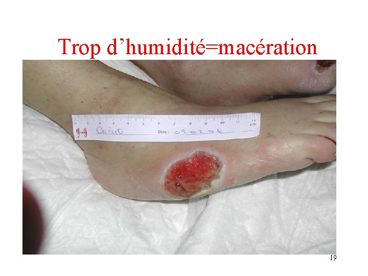 Trop d’humidité=macération • TROP HUMIDE 19 