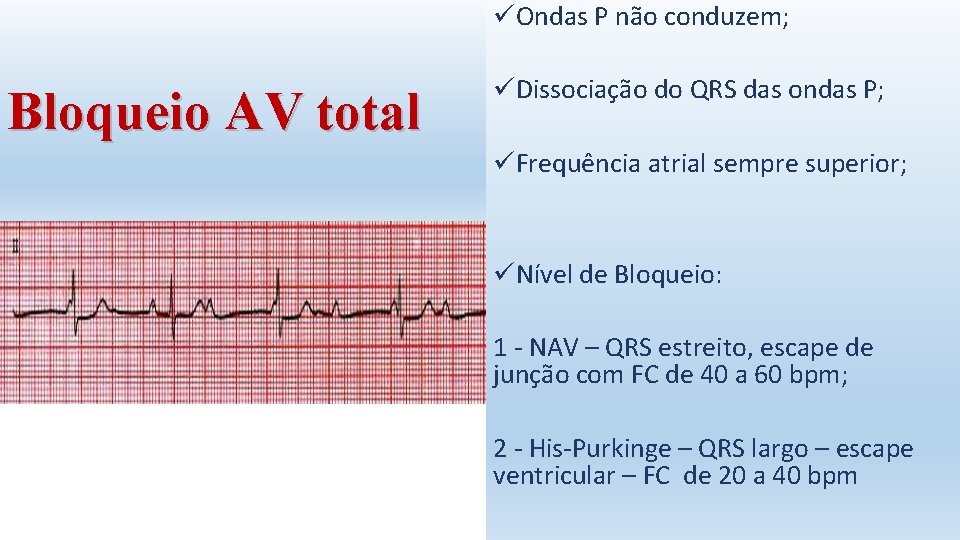 üOndas P não conduzem; Bloqueio AV total üDissociação do QRS das ondas P; üFrequência