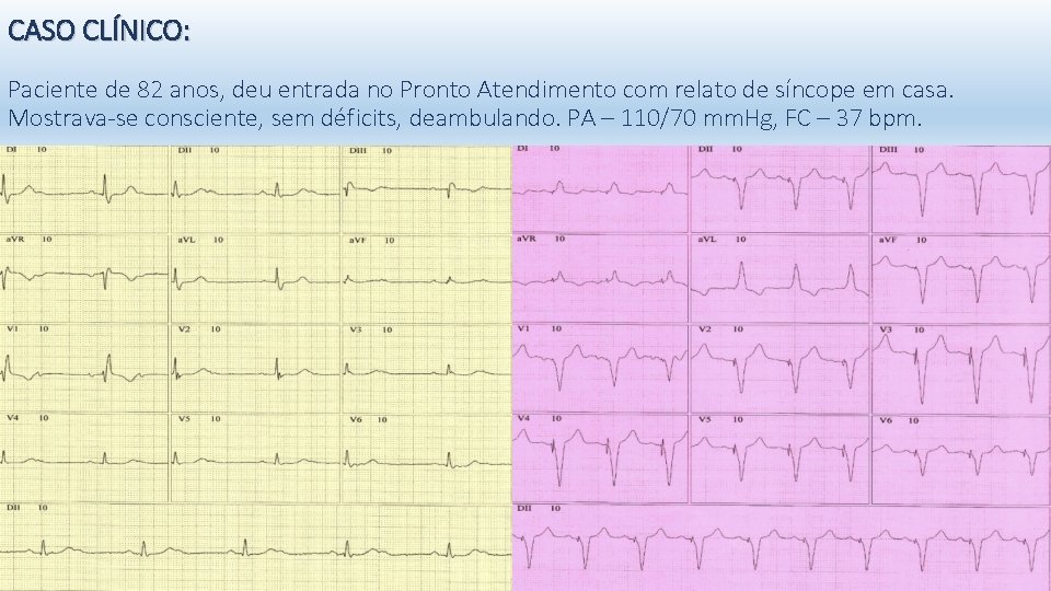 CASO CLÍNICO: Paciente de 82 anos, deu entrada no Pronto Atendimento com relato de
