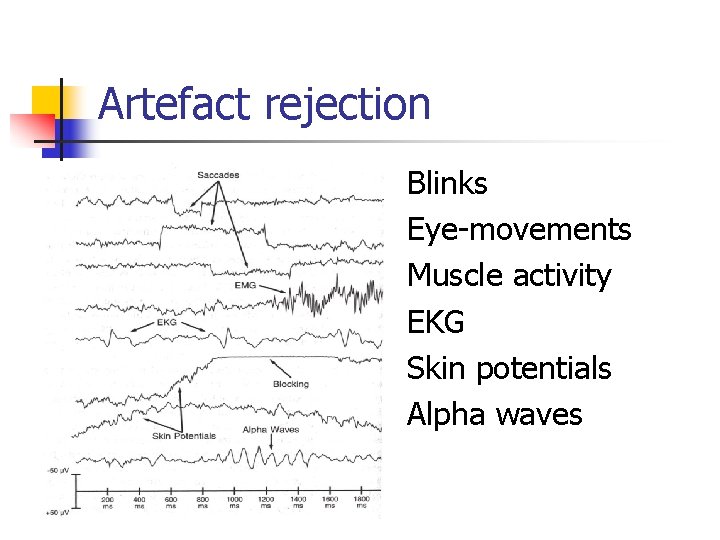 Artefact rejection Blinks Eye-movements Muscle activity EKG Skin potentials Alpha waves 